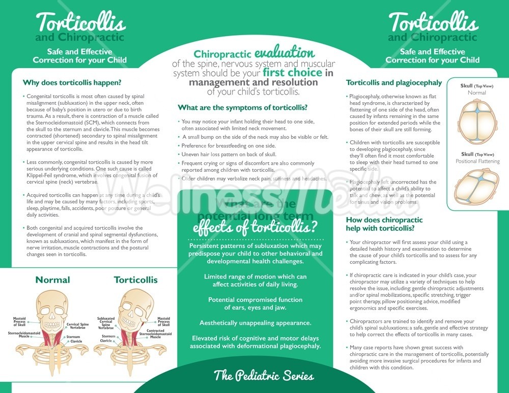 chiropractic torticollis brochure chiropractic brochures